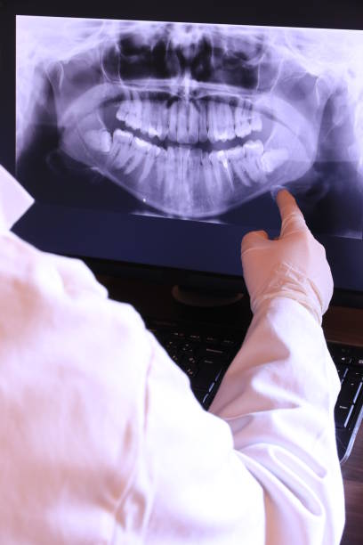 Best Broken or Chipped Tooth Repair in Blue Mound, TX