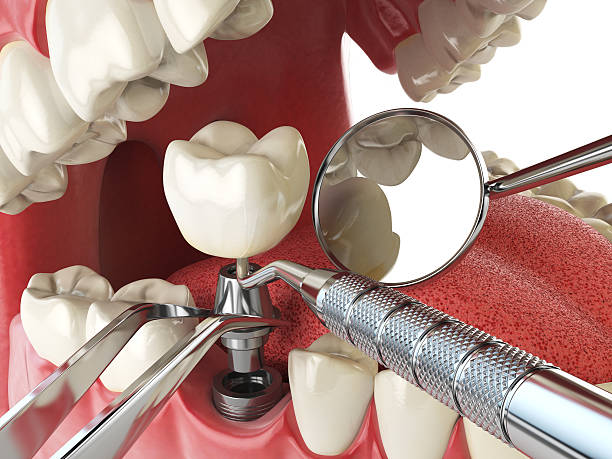 Best Emergency Cosmetic Dentistry (e.g., broken veneers) in Blue Mound, TX